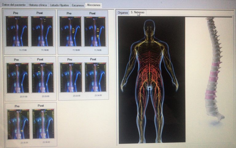 Visualizacion de sistema nervioso en software ADG