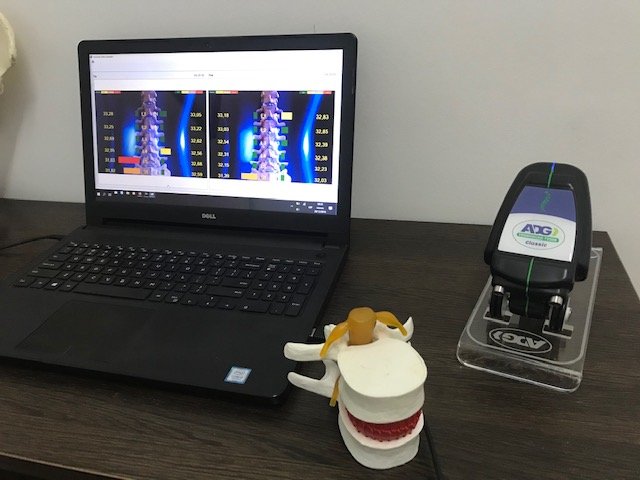 Software ADG conectado al Thermoscan